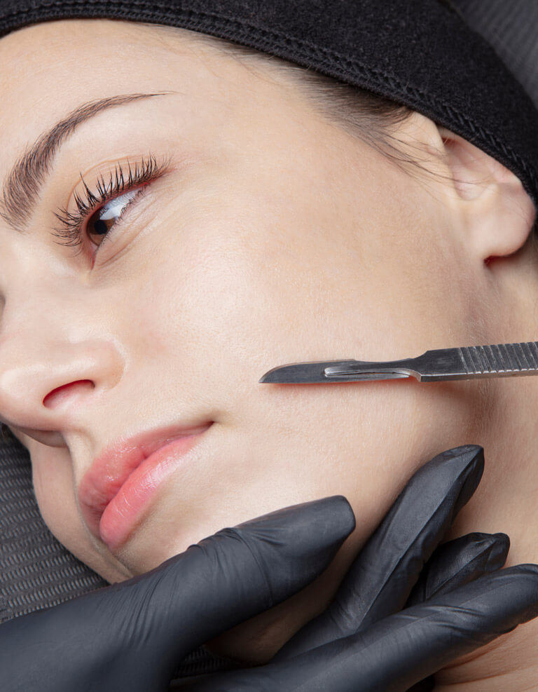 A close up of a woman's face while an unseen esthetician uses a microdermabrasion razor.