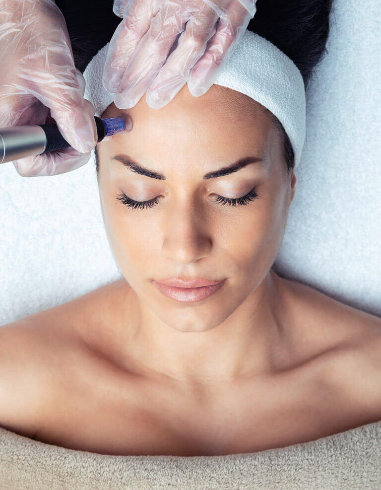 A woman wrapped in white towels lays down while receiving a cosmetic microneedling treatment.